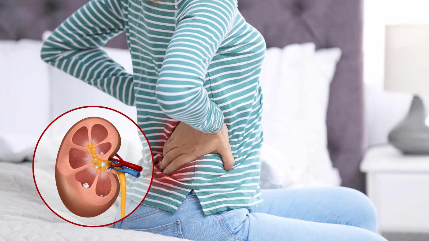 kidney natural supplements