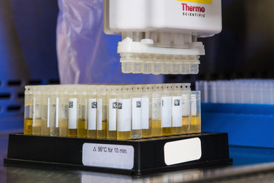 hemoglobin-in-your-urine